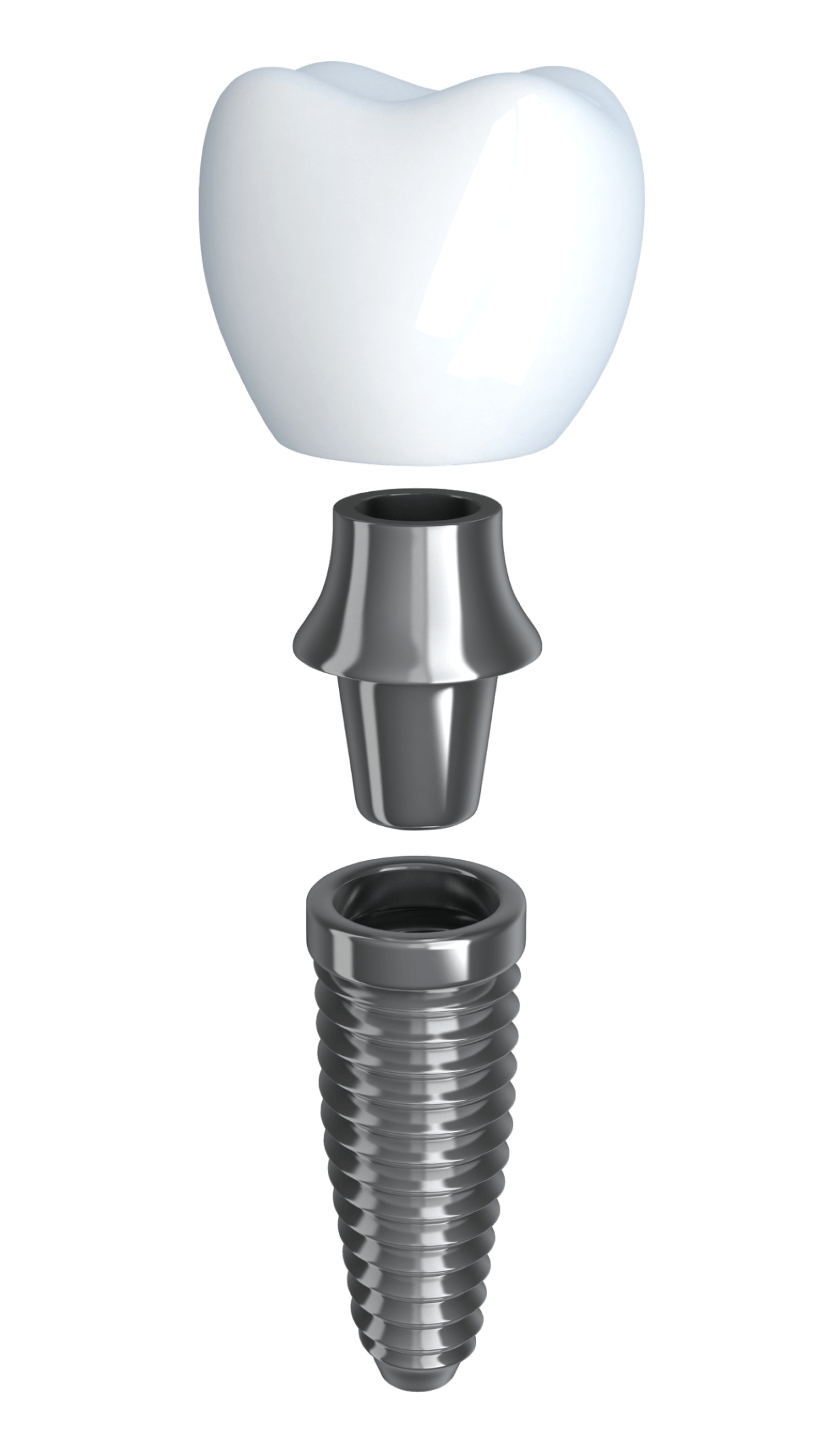 Имплантация зубов