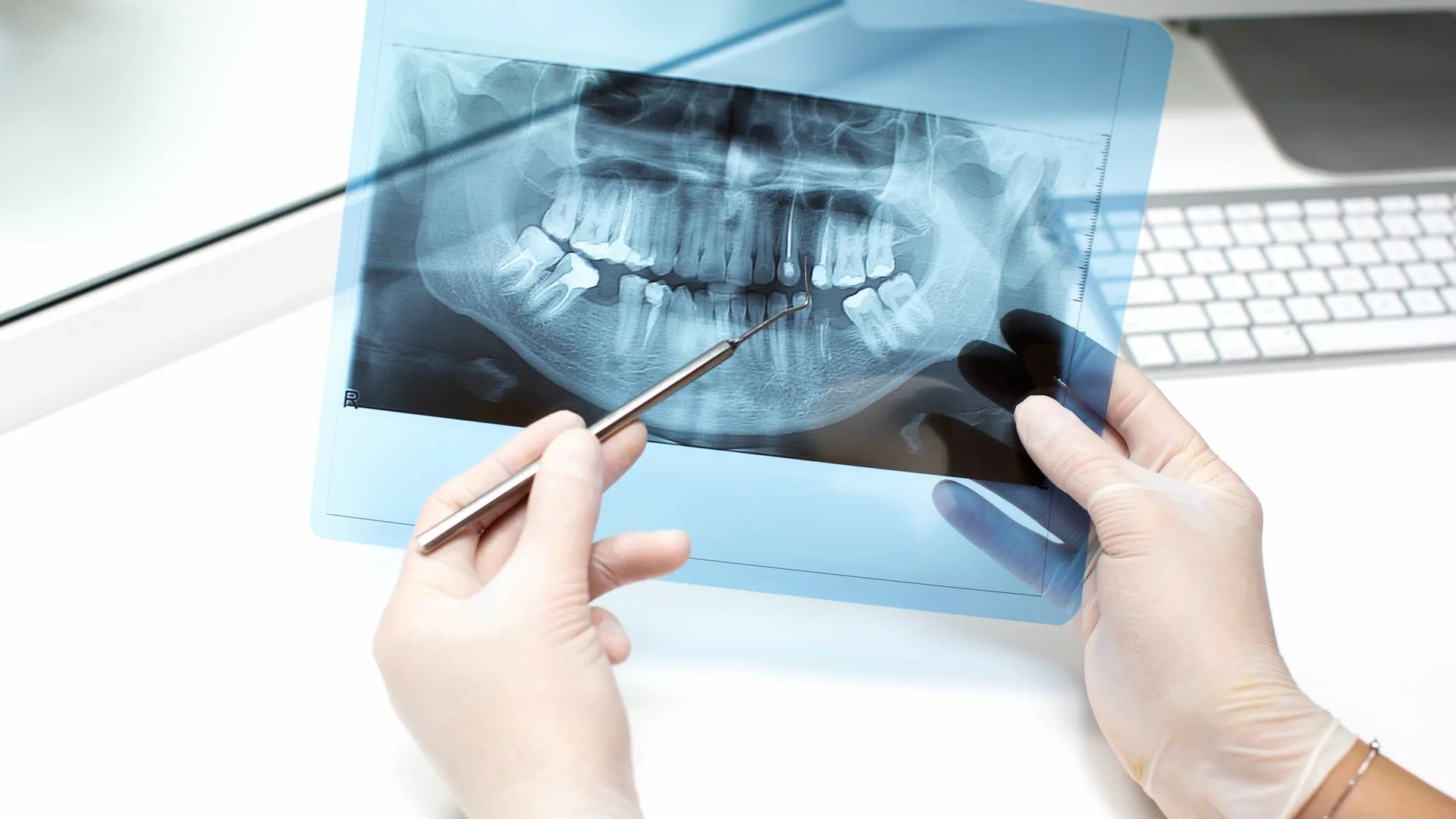 Рентгенодиагностика